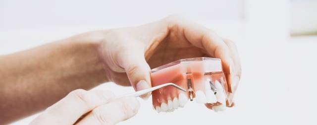 implantologia_dental_madrid